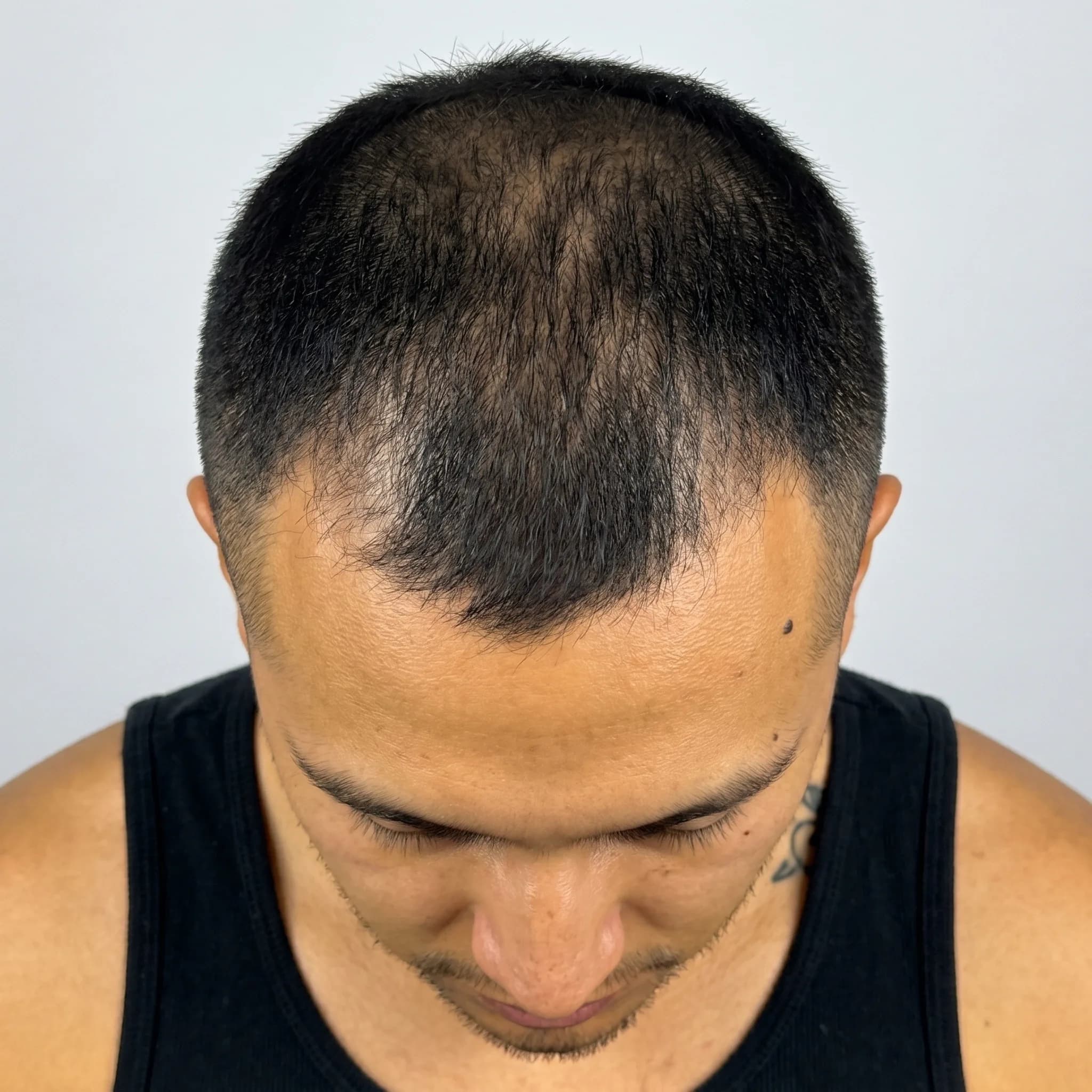 Antes